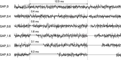 80 Hz auditory steady state responses (ASSR) elicited by silent gaps embedded within a broadband noise